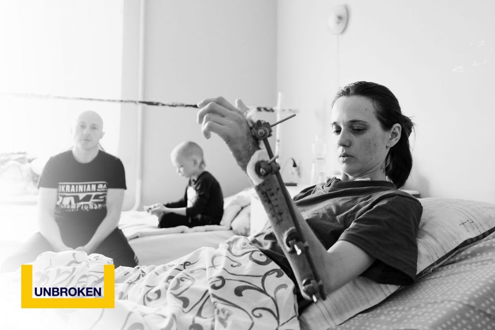 Фото 1: «Російська ракета забрала в неї руку, ногу та дитину, що носила під серцем»: історія 35-річної Катерини з Лиману