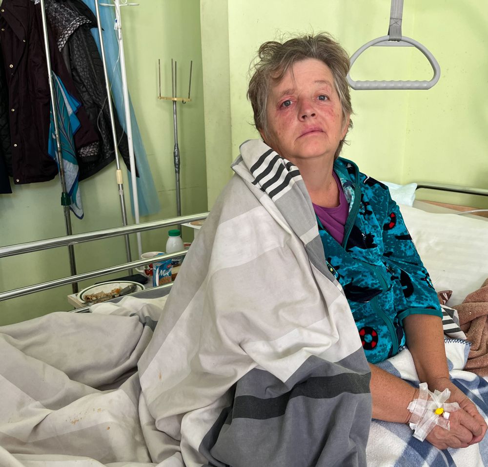Фото 1: У Львові медики врятували життя 56-річній жінці, яка мала велику аневризму головного мозку