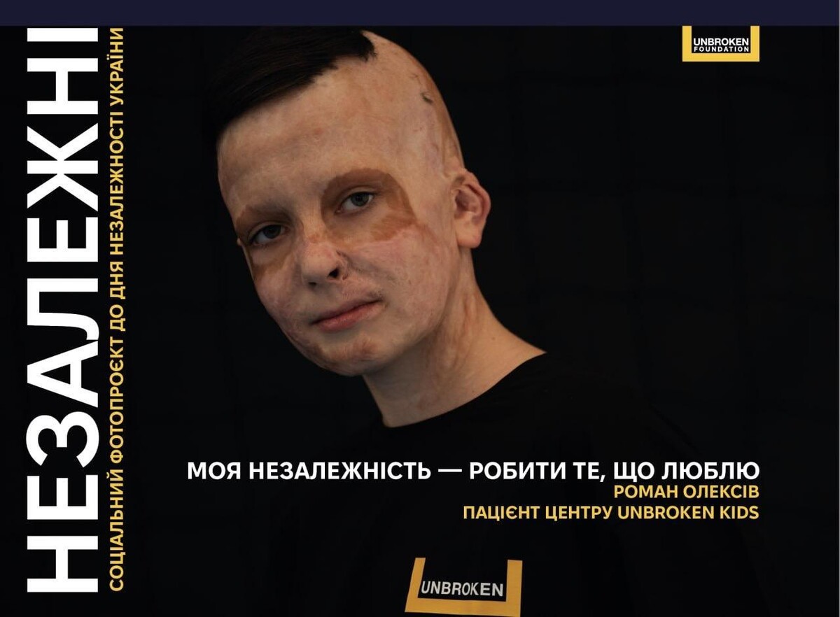 Фото 4: НЕЗАЛЕЖНІ: історії українців, які після поранень щодня виборюють право на власну незалежність