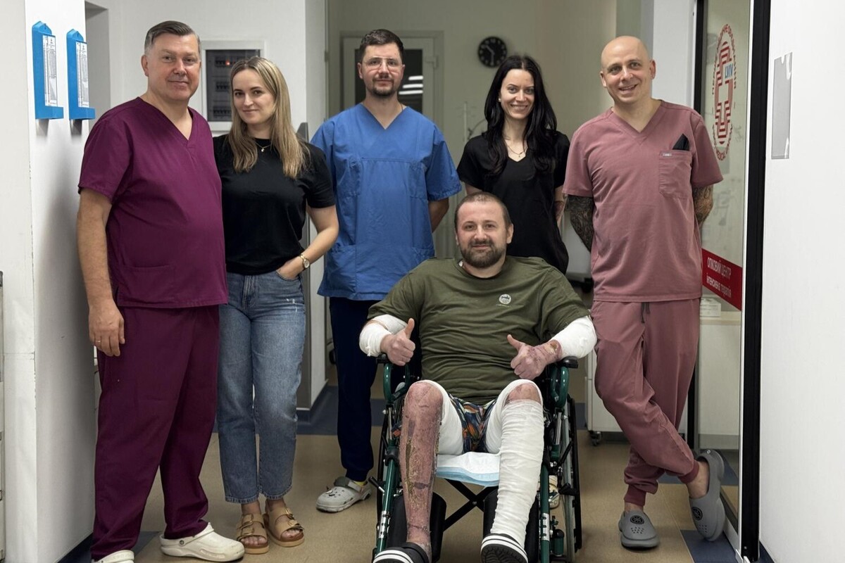 Фото 1: Шкіра риби та свині допомогла лікарям врятувати чоловіка, який отримав 80% опіків тіла