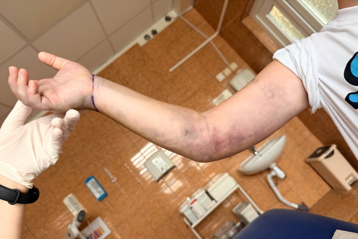 Фото 1: Вчасно доправили до лікарні: львівські лікарі врятували дитину, яку вкусила змія
