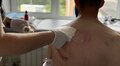 Львівські лікарі скріпили уламки кісток 28-річному чоловіку, який майже місяць страждав від болю