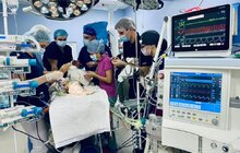 Фото 8: У Львові вперше трансплантували печінку однорічному хлопчику від посмертного донора