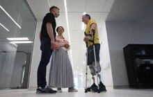 Фото 3: Перший в історії України пацієнт із вживленим у кістку протезом – ходить (фото, відео)