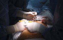 Фото 2: Унікальна трансплантація: у Львові вперше в Україні пересадили серце та легені одній людині (відео)