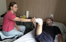 Фото 5: Переніс понад 20 операцій: 29-річний захисник готується до протезування ніг у центрі НЕЗЛАМНІ