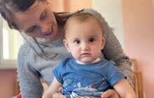 Фото 6: У Львові однорічній дитині вперше в Україні пересадили шкіру від посмертного донора