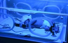 Фото 2: У Міському пологовому будинку №1 оновили обладнання на 2,7 млн. грн.