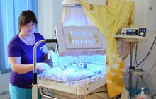 Фото 5: Міська дитяча лікарня отримала обладнання для лікувальної гіпотермії новонароджених