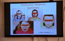 Фото 6: У Львові стартувала інформаційно-профілактична кампанія із запобігання опікам у дітей