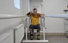 Фото 4: Перший в історії України пацієнт із вживленим у кістку протезом – ходить (фото, відео)