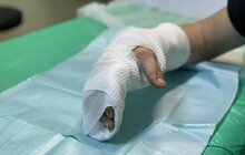 Фото 2: У Центрі НЕЗЛАМНІ лікують підлітка з Бахмута, який пораненим вибрався з-під заваленого будинку