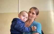 Фото 2: У Львові однорічній дитині вперше в Україні пересадили шкіру від посмертного донора