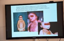 Фото 5: У Львові стартувала інформаційно-профілактична кампанія із запобігання опікам у дітей