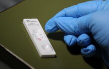 Фото 9: Лікарні швидкої допомоги передали тисячу експрес-тестів на антиген до СOVID