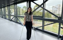 Фото 2: Львівські хірурги врятували від ампутації ногу поліцейській, яку чотири місяці тому збила нетвереза водійка