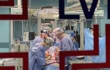 Фото 2: За ніч львівські медики провели чотири трансплантації, і одна з них – унікальна, бо подвійна: одночасно пересадили підшлункову та нирку (відео)