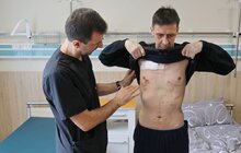 Фото 7: Місто оплатить перший місяць лікування львів’янина, якому вперше в Україні успішно пересадили легені