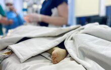 Фото 3: У Львові вперше трансплантували печінку однорічному хлопчику від посмертного донора