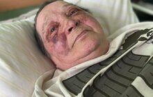 Фото 2: Львівські лікарі провели складну операцію журналістці та волонтерці з Херсона, щоб зберегти їй здатність ходити