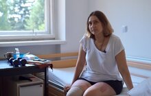 Фото 5: Оксана втратила ногу, пережила сім операцій, але залишилася незламною