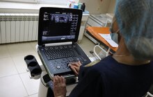 Фото 2: Сьогодні 8-ма міська клінічна лікарня отримала ультразвуковий діагностичний сканер Samsung HM70А