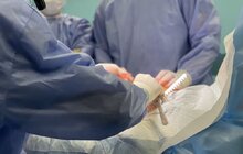 Фото 1: За ніч львівські медики провели чотири трансплантації, і одна з них – унікальна, бо подвійна: одночасно пересадили підшлункову та нирку (відео)