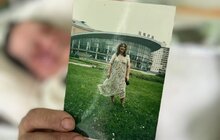 Фото 3: Львівські лікарі провели складну операцію журналістці та волонтерці з Херсона, щоб зберегти їй здатність ходити