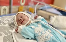 Фото 6: Львівські кардіохірурги врятували дитину з критичним аортальним стенозом