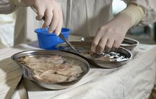 Фото 1: У Львові однорічній дитині вперше в Україні пересадили шкіру від посмертного донора