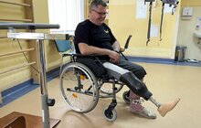 Фото 9: У центрі НЕЗЛАМНІ українець отримав протез за чотири години