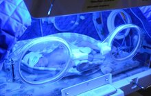 Фото 1: Щороку у Львові передчасно народжується близько 600 немовлят: як виходжують таких діток