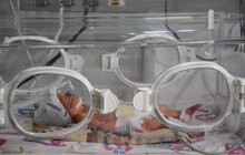 Фото 2: Міська дитяча лікарня Львова отримала 4 надсучасні інкубатори для виходжування новонароджених діток