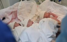 Фото 2: Вперше у лікарні святого Миколая народилася природна трійня: такий випадок трапляється раз на 80 тисяч вагітностей