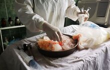 Фото 2: У лікарні швидкої медичної допомоги Львова вперше провели операцію з пересадки серця та двох нирок