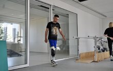 Фото 3: У центрі НЕЗЛАМНІ протезували 32-річного захисника, який у російському полоні втратив обидві ноги