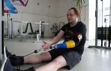 Фото 1: Львівські лікарі без жодних операцій відновили здоров’я чоловіка, який місяцями мучився від болю у хребті