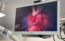 Фото 2: У Львові вперше в історії української медицини провели унікальну операцію на мозку дитині