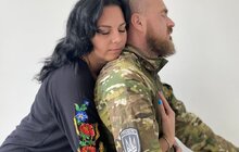 Фото 2: Переніс 17 операцій і вижив заради коханої: у центрі НЕЗЛАМНІ відновлюється 37-річний захисник з Київщини
