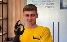 Фото 1: У центрі НЕЗЛАМНІ у Львові 24-річному захиснику встановили біонічний протез руки