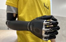 Фото 2: У центрі НЕЗЛАМНІ у Львові 24-річному захиснику встановили біонічний протез руки
