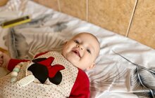Фото 3: У Львові врятували немовля з аномалією, що спровокувала кишкову непрохідність та крововилив у мозок 