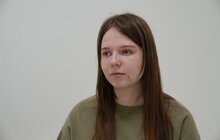 Фото 3: Львівські лікарі повертають красу дівчині з Сіверодонецька, обличчя якої понівечила російська ракета