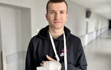 Фото 2: У Львові хірурги наново сформували палець руки з ребра