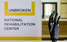 Фото 1: Протези для незламних: стартує благодійний збір на біонічні протези для українців (відео)