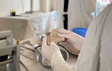 Фото 7: У Львові однорічній дитині вперше в Україні пересадили шкіру від посмертного донора