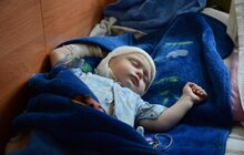 Фото 13: У Львові стартувала інформаційно-профілактична кампанія із запобігання опікам у дітей