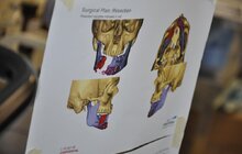 Фото 4: Американські хірурги місії Face to Face прооперують 30 українців у Львові