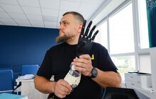Фото 2: Протези для незламних: стартує благодійний збір на біонічні протези для українців (відео)