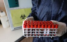 Фото 4: У Львові на COVID-19 розпочали тестувати освітян, які працюватимуть під час ЗНО